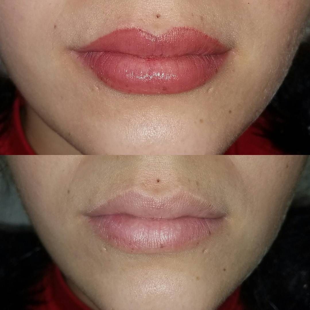 What Is Lip Blushing 2023: My Before/After Pics and Side Effects