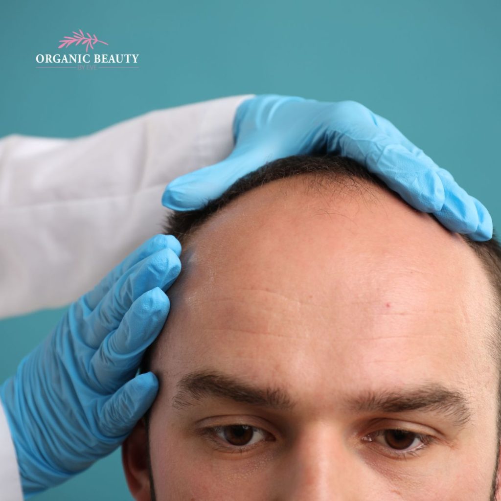 micro scalp pigmentation services